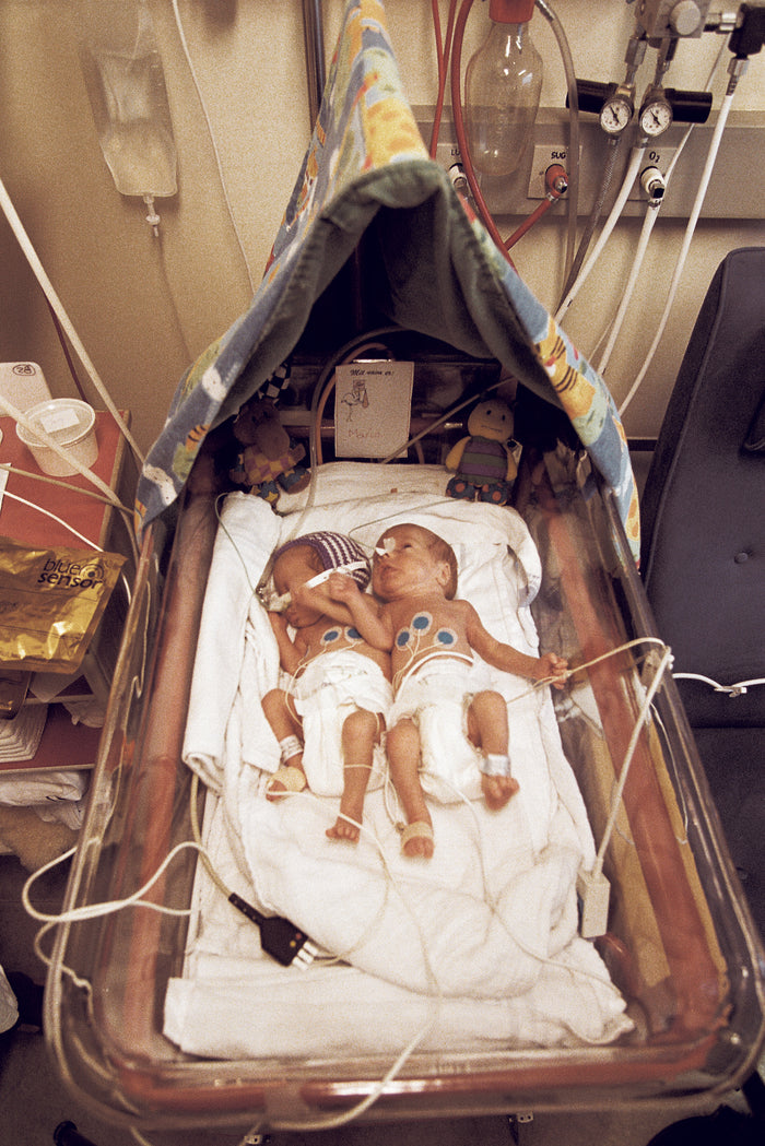 WhiteSensor一次性使用心電電極 - 初生嬰兒監測